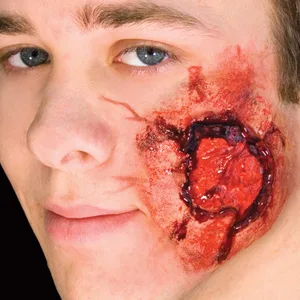OPEN WOUND WITH MUSCLE TISSUE LATEX APPLIANCE