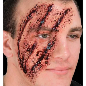 SHREDDED LATEX INJURY
